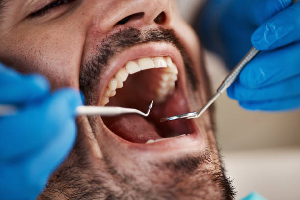 Best Emergency Gum Treatment in Wayne, MI