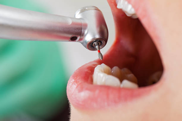 Best Emergency Gum Treatment in Wayne, MI